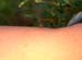 mosquito